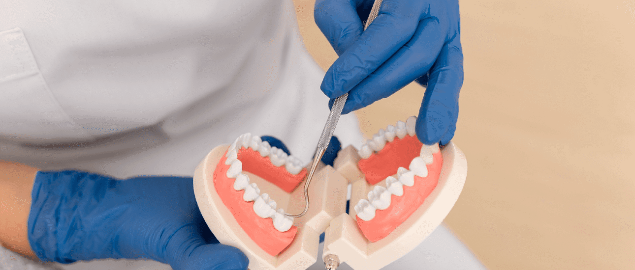 At Holt Orthodontics in Twinsburg, OH, a gloved practitioner demonstrates how to identify and treat an overbite using a dental tool on a plastic model of teeth and gums.