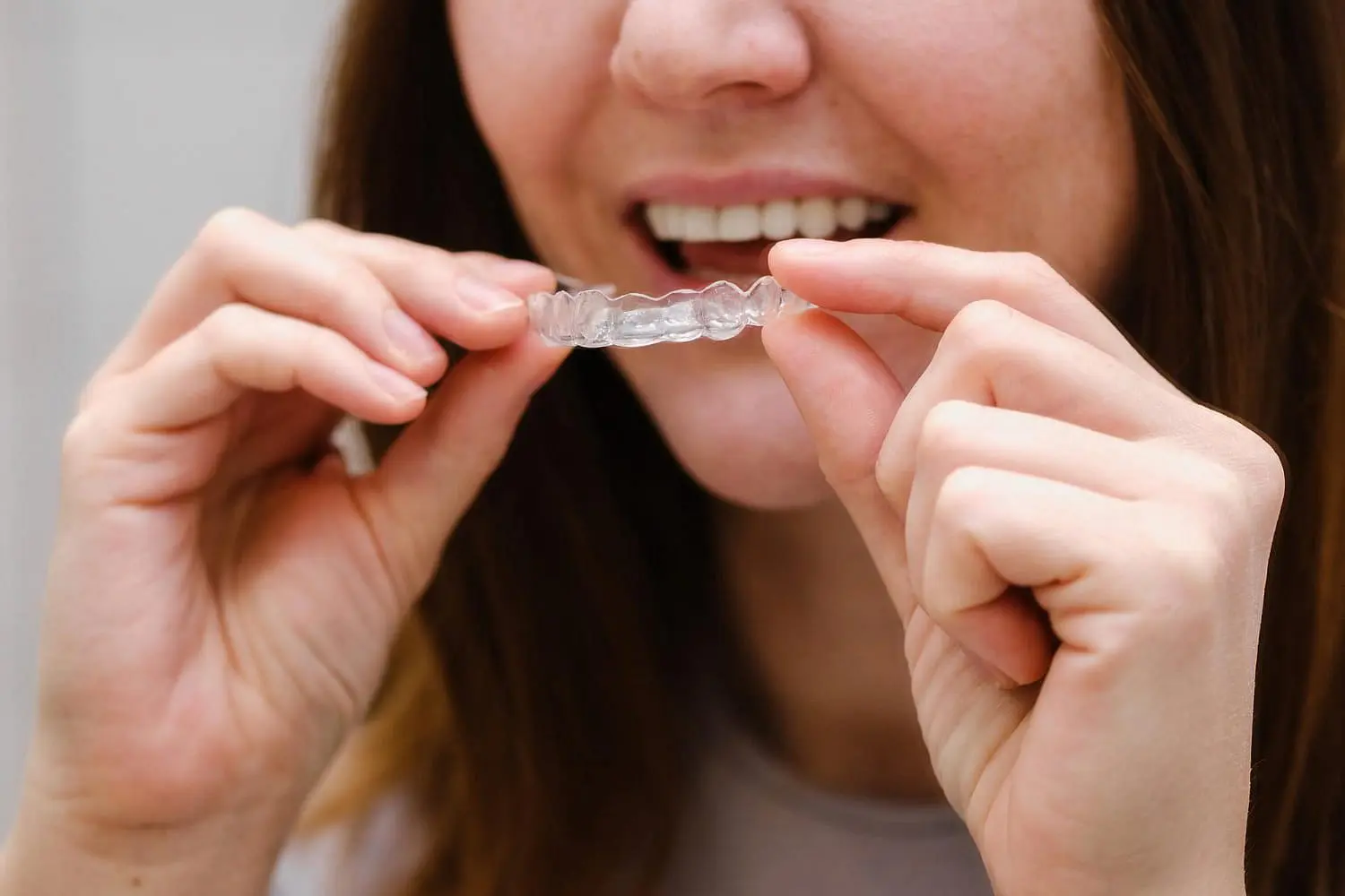 At Holt Orthodontics in Twinsburg, OH, a person holds a clear dental aligner near their mouth, ready to fit it over their teeth—a key step in the Invisalign vs Braces process.