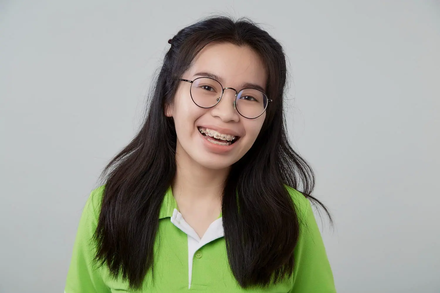 A young person with long dark hair, glasses, and braces—showing an underbite—smiles at the camera in a green collared shirt against a plain background, representing Holt Orthodontics in Twinsburg, OH.