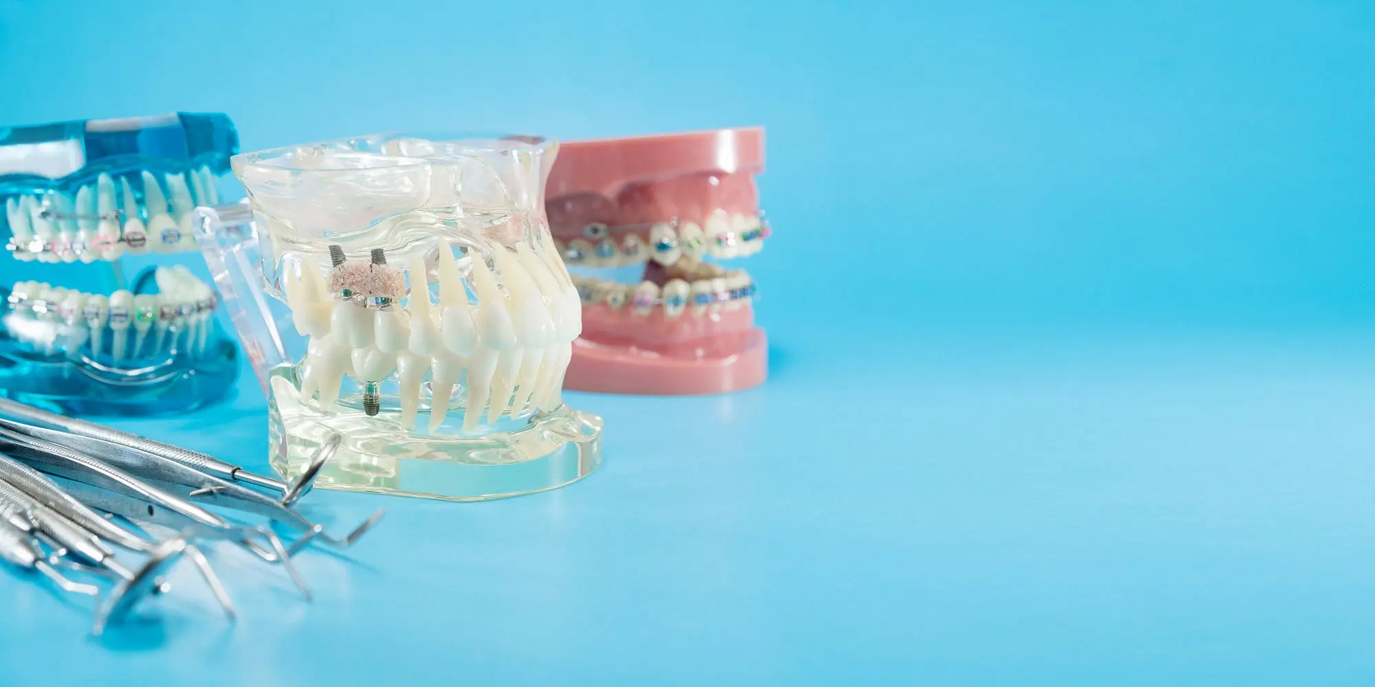 On a blue background, Holt Orthodontics in Twinsburg, OH displays three dental models with metal braces alongside a set of dental tools.