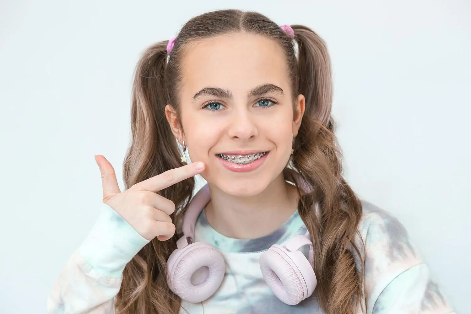 A teen girl with long brown hair in pigtails, wearing pastel headphones around her neck, smiles at the camera and points to her teeth to show off her affordable braces from Holt Orthodontics in Twinsburg, OH.