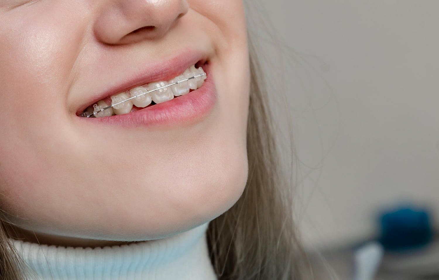 A confident smile reveals ceramic braces on clear teeth at Holt Orthodontics in Twinsburg, OH.