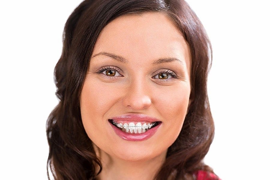 A woman with long brown hair smiles, displaying ceramic braces at Holt Orthodontics in Twinsburg, OH, against a white background.