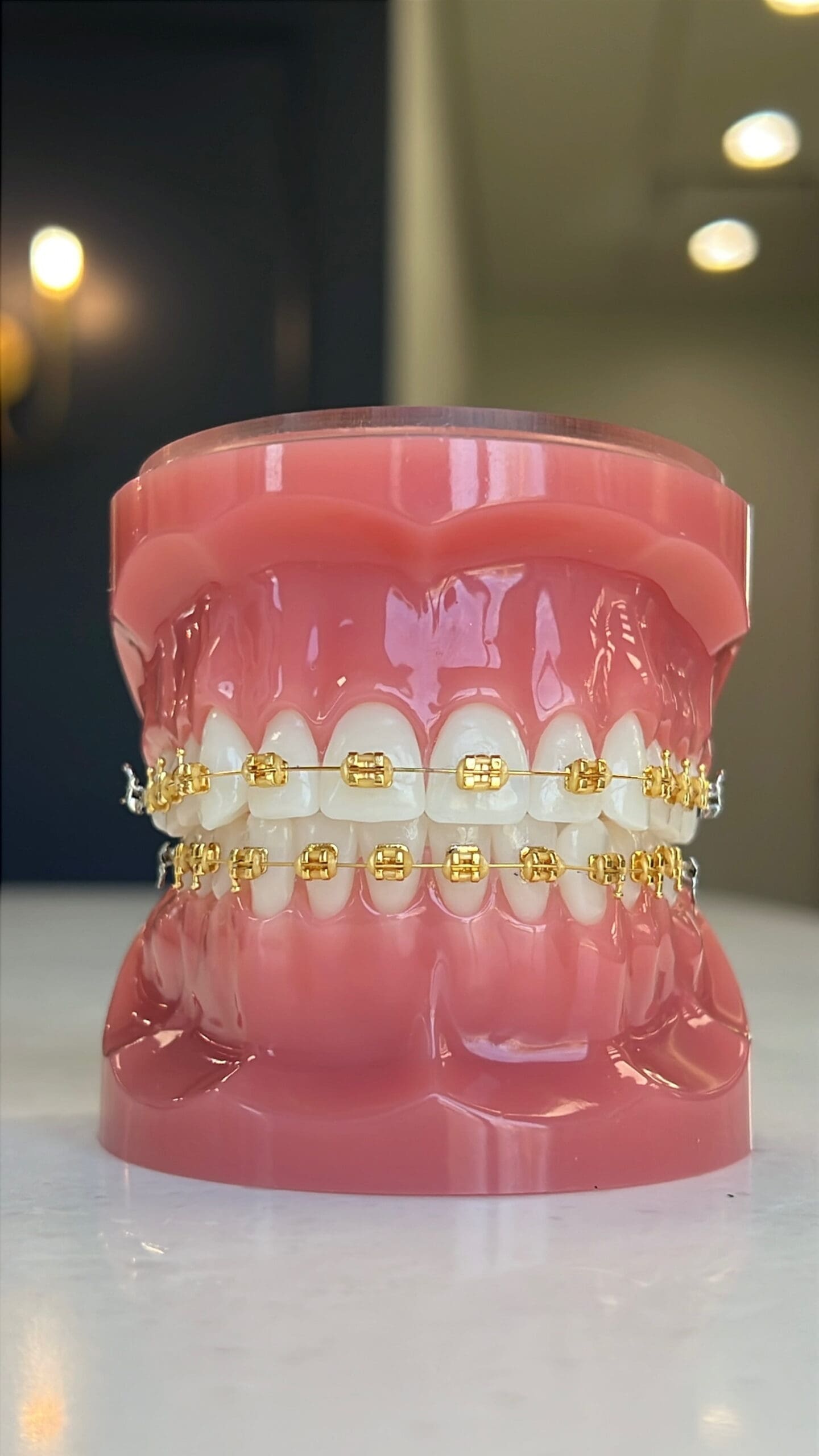 Upper and lower teeth with gold braces brackets and wires are shown on a dental model at Holt Orthodontics in Twinsburg, OH.
