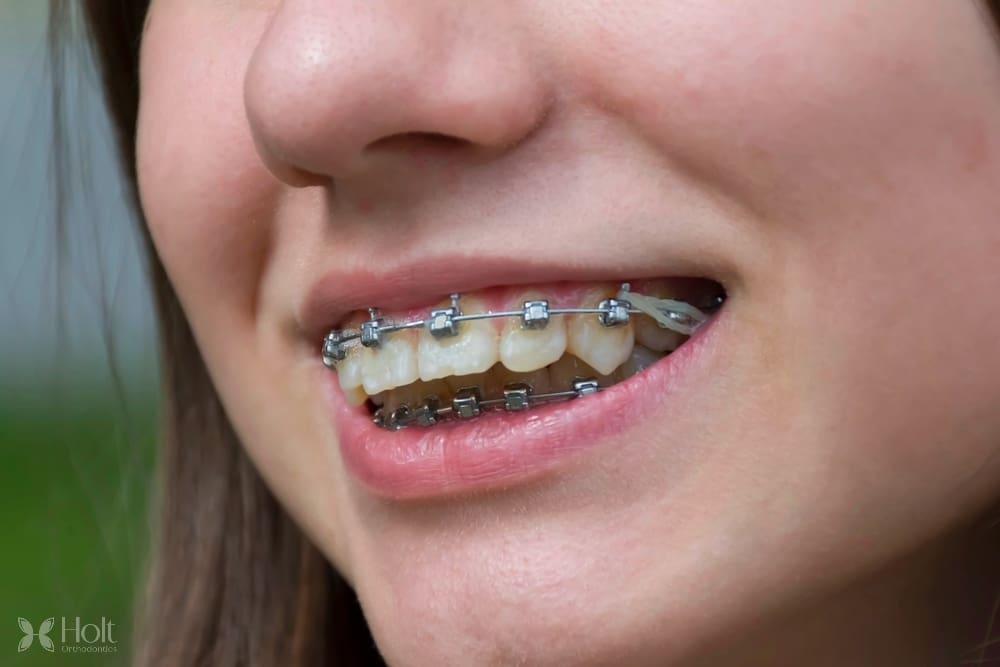 Holt Orthodontics